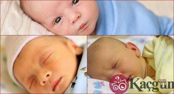 Yeni Doğan Bebeklerde Sarılık Kaç Gün Sürer?